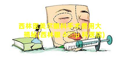 西林医美尔眼科手术费用大揭秘(西林眼 🌵 科医院)